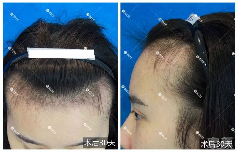 https://img.miyanlife.com/mnt/timg/171230/14054MD9-7.jpg