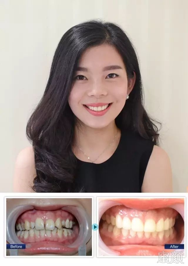 https://img.miyanlife.com/mnt/timg/171231/1149452504-4.jpg