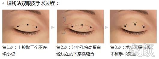 https://img.miyanlife.com/mnt/timg/171231/12093U4U-6.jpg