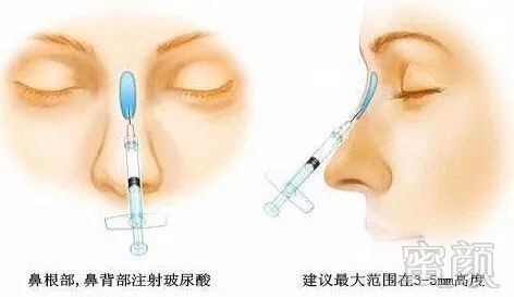 https://img.miyanlife.com/mnt/timg/171231/121H92204-2.jpg