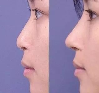 https://img.miyanlife.com/mnt/timg/171231/121H944S-4.jpg