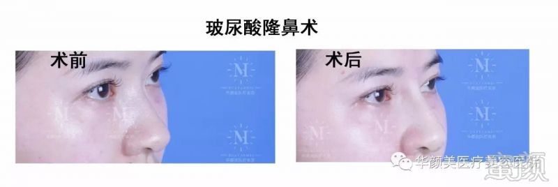 https://img.miyanlife.com/mnt/timg/171231/121Ha640-3.jpg