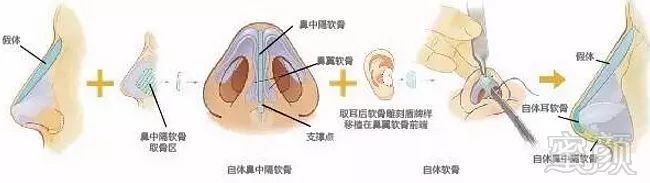 https://img.miyanlife.com/mnt/timg/171231/1234415611-5.jpg