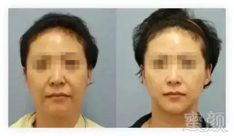 https://img.miyanlife.com/mnt/timg/171231/123S62936-2.jpg