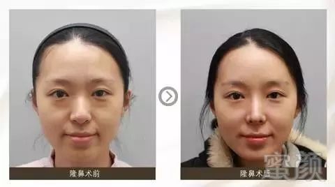 https://img.miyanlife.com/mnt/timg/171231/123SBK3-4.jpg