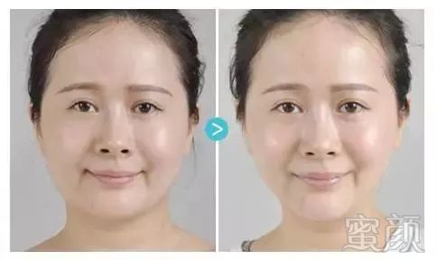 https://img.miyanlife.com/mnt/timg/171231/123SC2O-3.jpg