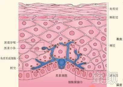 案例图片