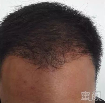 https://img.miyanlife.com/mnt/timg/171231/132H131P-5.jpg