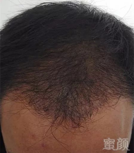 https://img.miyanlife.com/mnt/timg/171231/132H22241-6.jpg