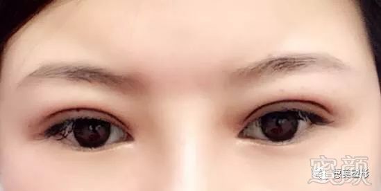 https://img.miyanlife.com/mnt/timg/171231/132KTb3-1.jpg