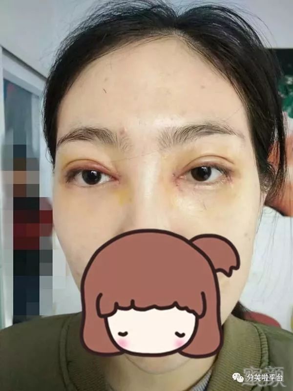 https://img.miyanlife.com/mnt/timg/171231/132SH005-7.jpg