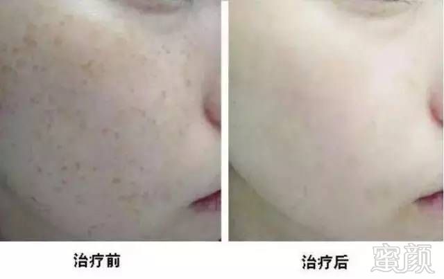 https://img.miyanlife.com/mnt/timg/180101/1205121229-5.jpg