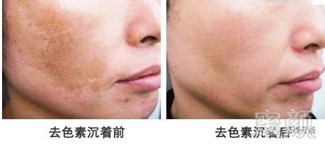 https://img.miyanlife.com/mnt/timg/180101/121U13395-2.jpg