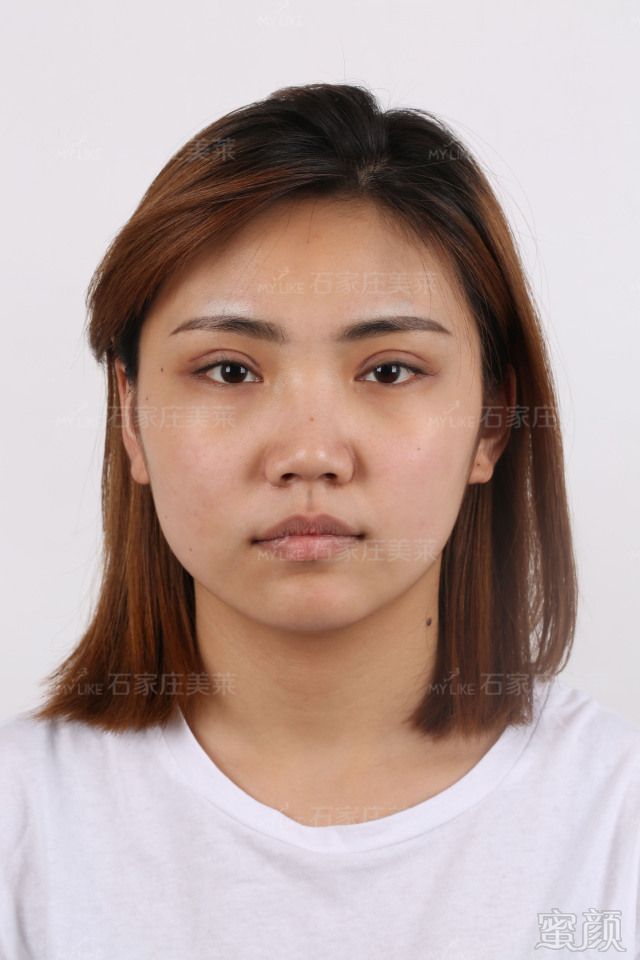 https://img.miyanlife.com/mnt/timg/180101/1315102603-10.jpg