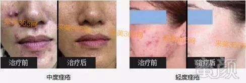 https://img.miyanlife.com/mnt/timg/180101/131UJa2-3.jpg
