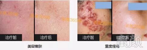 https://img.miyanlife.com/mnt/timg/180101/131UK437-2.jpg