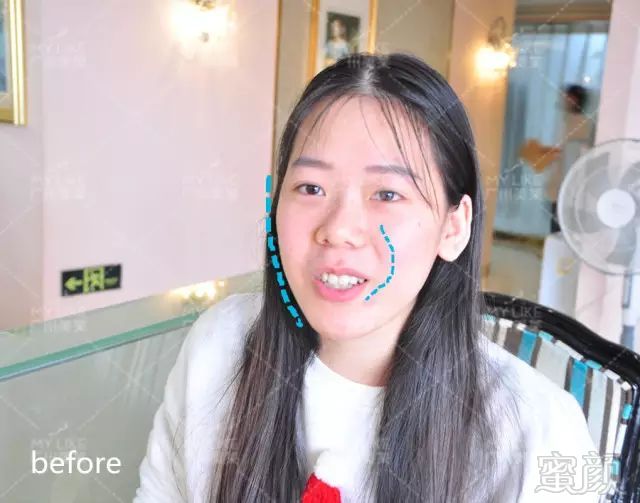 https://img.miyanlife.com/mnt/timg/180101/132320K36-2.jpg