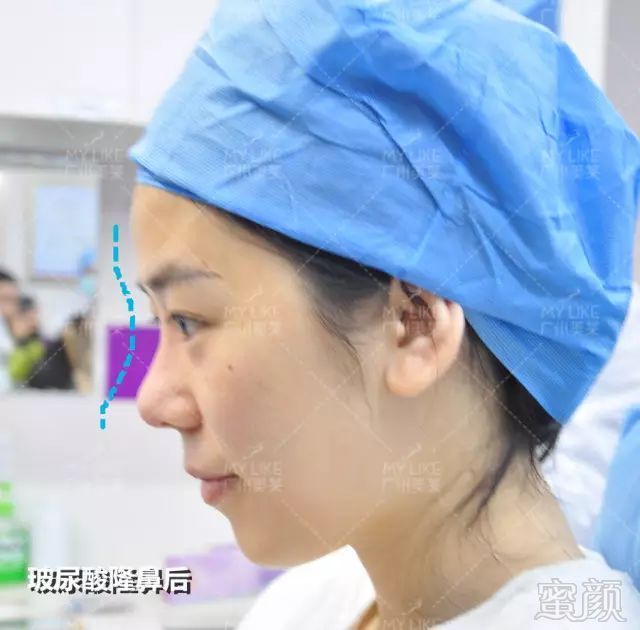 https://img.miyanlife.com/mnt/timg/180101/13232252W-7.jpg