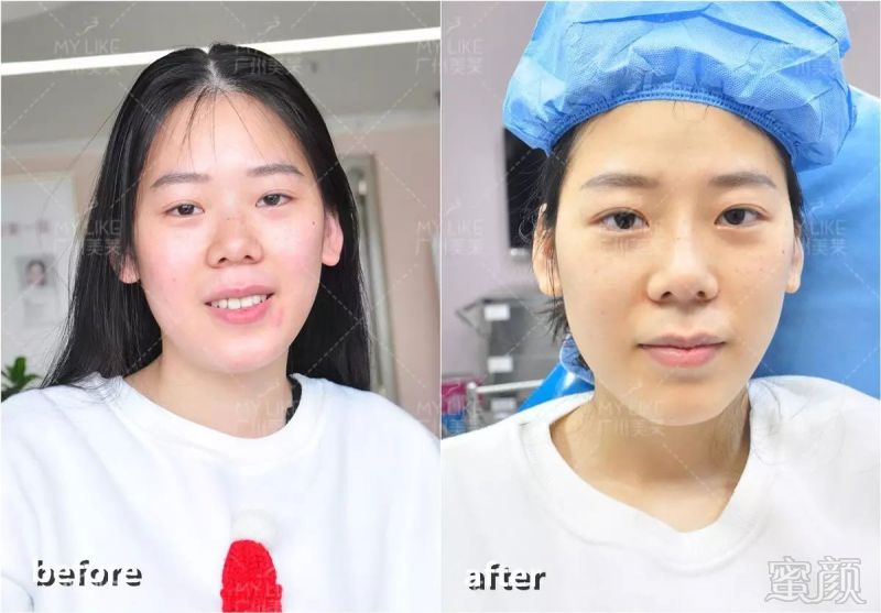 https://img.miyanlife.com/mnt/timg/180101/1323233D2-10.jpg