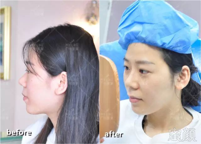 https://img.miyanlife.com/mnt/timg/180101/1323235642-9.jpg