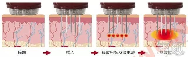 https://img.miyanlife.com/mnt/timg/180102/1059592C2-8.jpg