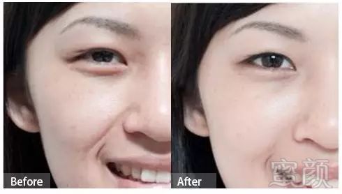 https://img.miyanlife.com/mnt/timg/180102/1059594M4-9.jpg