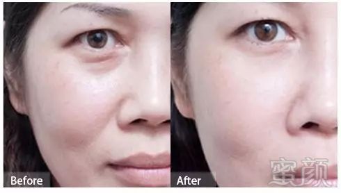 https://img.miyanlife.com/mnt/timg/180102/1100006292-10.jpg