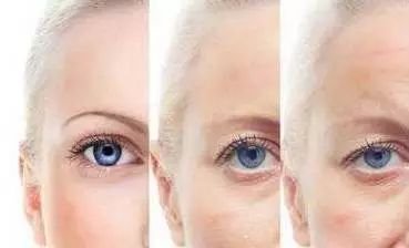 https://img.miyanlife.com/mnt/timg/180102/1139503307-3.jpg