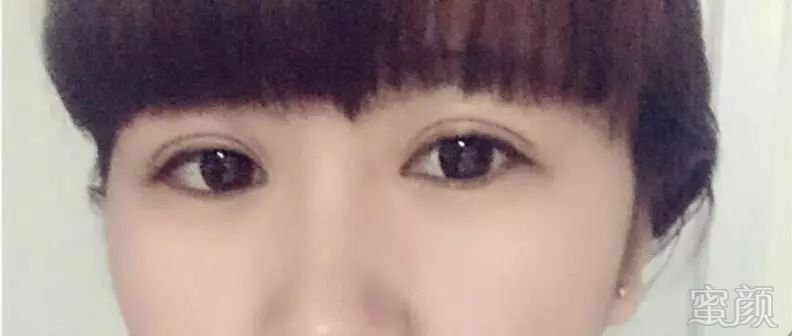 https://img.miyanlife.com/mnt/timg/180102/1139503R4-1.jpg
