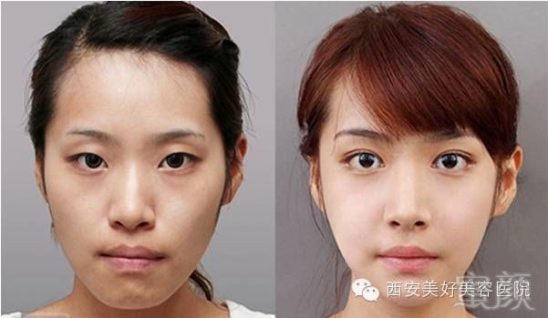 https://img.miyanlife.com/mnt/timg/180102/113951F08-7.jpg