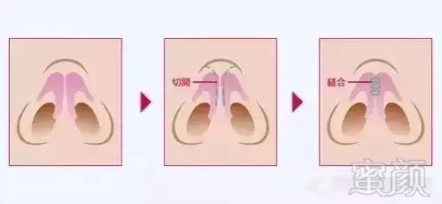 https://img.miyanlife.com/mnt/timg/180103/1154056222-6.jpg