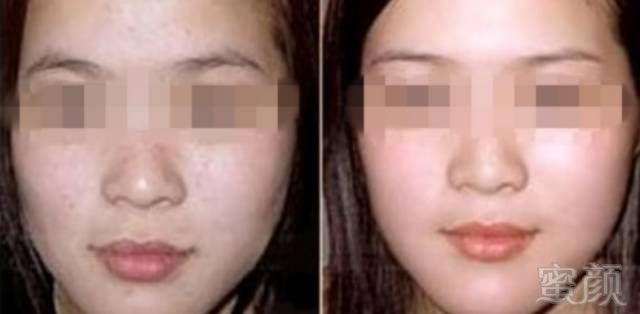 https://img.miyanlife.com/mnt/timg/180103/122A213V-4.jpg