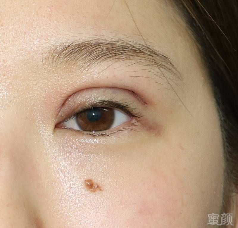 https://img.miyanlife.com/mnt/timg/180103/1233535542-4.jpg