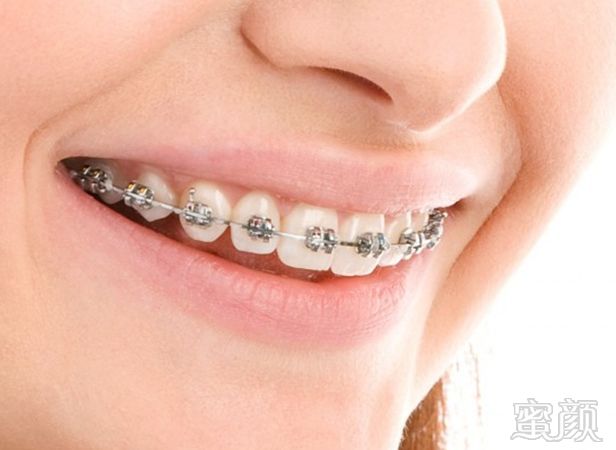 https://img.miyanlife.com/mnt/timg/180103/1236011417-1.jpg