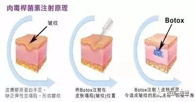 案例图片