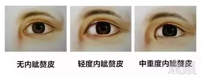 https://img.miyanlife.com/mnt/timg/180103/133UB147-3.jpg