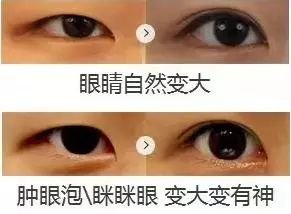 https://img.miyanlife.com/mnt/timg/180103/133UH0B-12.jpg