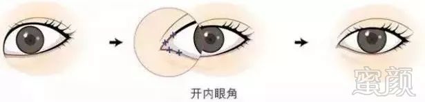 https://img.miyanlife.com/mnt/timg/180103/133UJE6-8.jpg