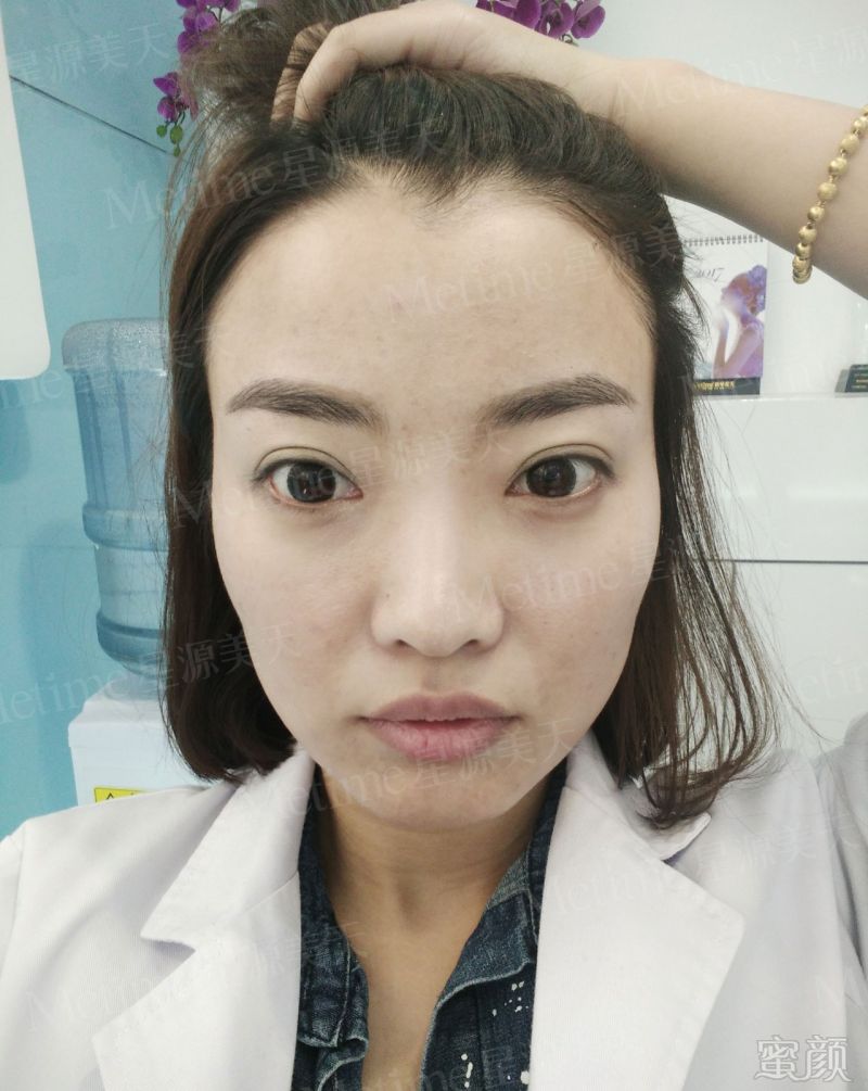 https://img.miyanlife.com/mnt/timg/180104/10555641D-1.jpg