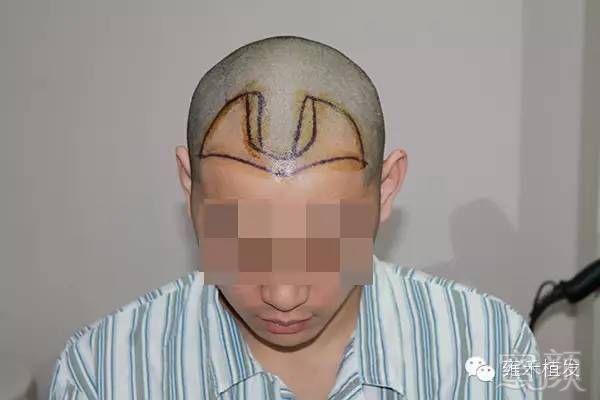 https://img.miyanlife.com/mnt/timg/180104/111Ha5D-3.jpg