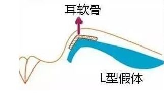 https://img.miyanlife.com/mnt/timg/180104/113H21936-1.jpg