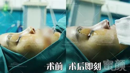 https://img.miyanlife.com/mnt/timg/180104/113H36319-6.jpg