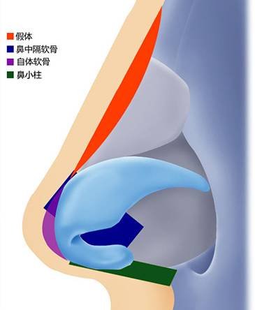 https://img.miyanlife.com/mnt/timg/180104/113H3I64-4.jpg