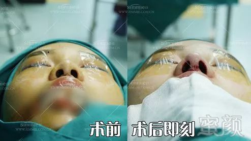 https://img.miyanlife.com/mnt/timg/180104/113H425T-7.jpg