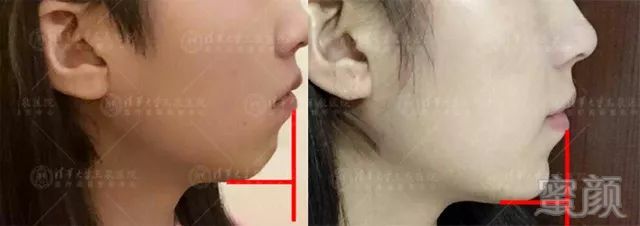 https://img.miyanlife.com/mnt/timg/180104/114PLV0-0.jpg