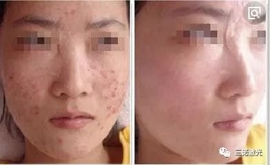 https://img.miyanlife.com/mnt/timg/180104/1202152412-6.jpg