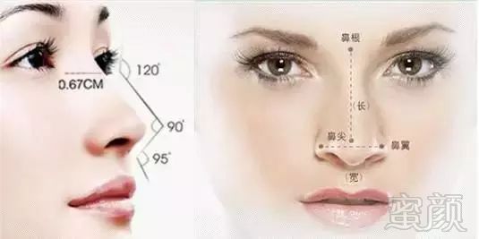 https://img.miyanlife.com/mnt/timg/180104/13231GA5-2.jpg