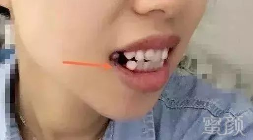 https://img.miyanlife.com/mnt/timg/180104/1330391246-15.jpg