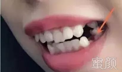 https://img.miyanlife.com/mnt/timg/180104/1330395P4-14.jpg