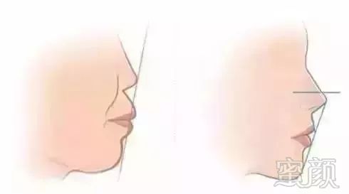 https://img.miyanlife.com/mnt/timg/180104/13303U5a-2.jpg